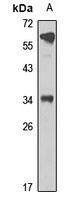 Anti-ALKBH2 Antibody