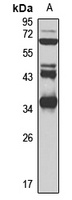 Anti-ALKBH4 Antibody