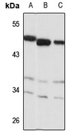 Anti-ALKBH5 Antibody