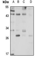 ALKBH6 antibody