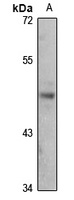Anti-ALX4 Antibody
