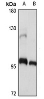 Anti-ANAPC2 Antibody