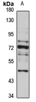 Anti-ANKRD13A Antibody