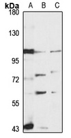 Anti-ANO6 Antibody