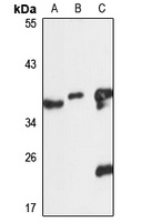 Annexin A13 antibody