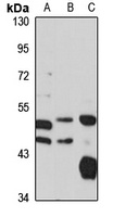 Anti-AP3M1 Antibody