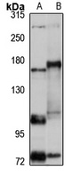 Anti-ARAP2 Antibody