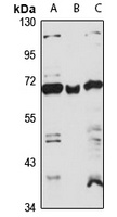 Anti-COPD Antibody