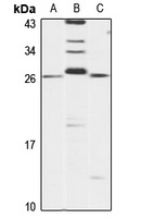 Anti-ARFRP1 Antibody
