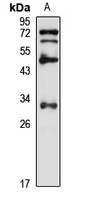 ARL10 antibody