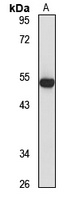 Anti-ASCC1 Antibody