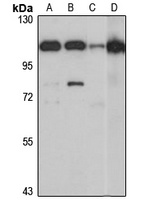 ASCC2 antibody