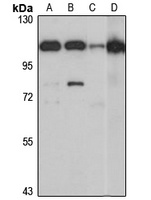Anti-ASCC2 Antibody