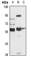 Anti-ASIC2 Antibody