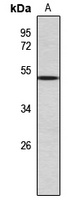 Anti-ASMT Antibody