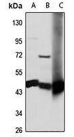 Anti-ASS1 Antibody