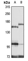 Anti-ASXL1 Antibody