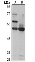 Anti-ASZ1 Antibody