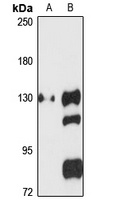 ATP13A1 antibody
