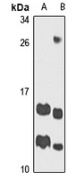 Anti-ATP5J Antibody