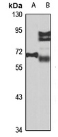 ATP6V0A4 antibody