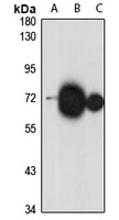 Anti-ATP6V1A Antibody