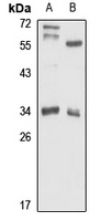 Anti-ATP6V1D Antibody