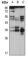 ATP6V1E2 antibody
