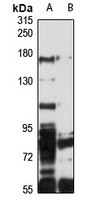 Anti-ATP8A1 Antibody