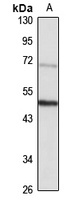 B3GALT3 antibody