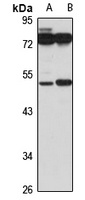 beta 3Gn-T3 antibody