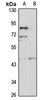 beta 3Gn-T6 antibody