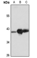 B4GALT4 antibody