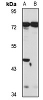 BCMO1 antibody