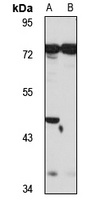 Anti-BCMO1 Antibody