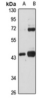 Anti-BDH1 Antibody