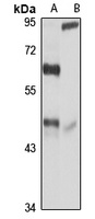 Anti-BHMT Antibody
