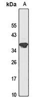 BLVRA antibody