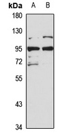 Anti-BRAT1 Antibody