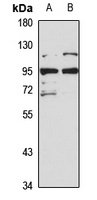 BRAT1 antibody