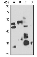 Anti-BRCC3 Antibody