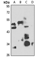 BRCC3 antibody