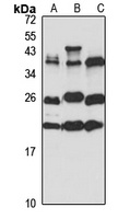 Anti-BTF3 Antibody