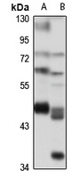 Anti-BZW1 Antibody