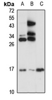 IL-25 antibody