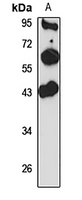 Anti-C1GALT1 Antibody
