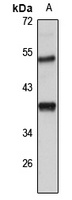 Anti-CTRP4 Antibody