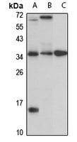 CTRP5 antibody