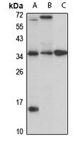 Anti-CTRP5 Antibody