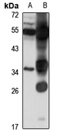 GPR77 antibody